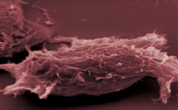 Visión microscópica de células cancerígenas./Archivo