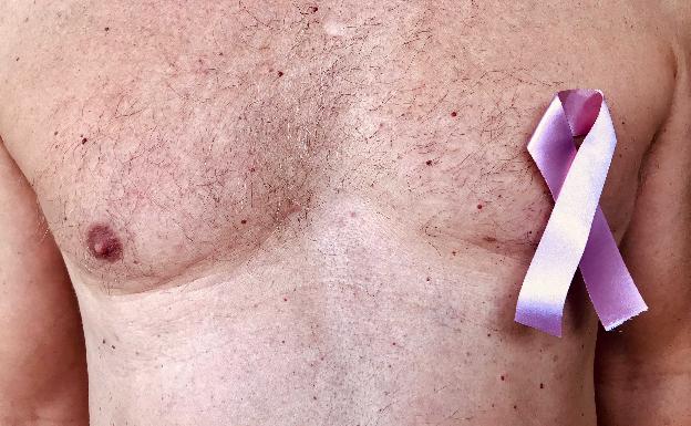 el cáncer de próstata es contagioso antes de ser operado