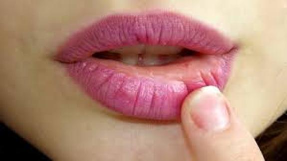 Dieta para evitar herpes labial Dieta para evitar herpes labial